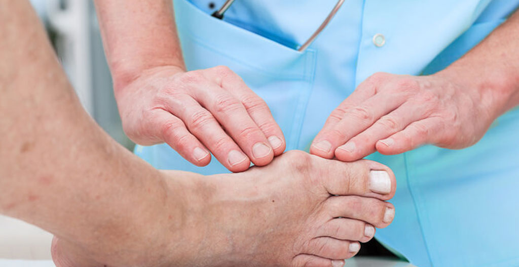 Consultation entre patient et chirurgien orthopédiste spécialisé du pied pour discussion sur l'indication opératoire d'un hallux valgus